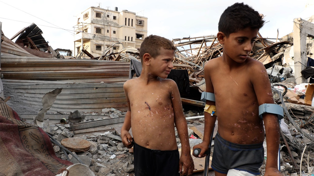 Dos niños, Zain y Jude, de la familia Al-Anqar, con heridas visibles causadas por la explosión de un artefacto sospechoso de guerra en Gaza.